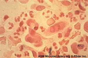 micoplasma ureaplasma dureri articulare)
