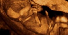 Europa Vrea Sa Interzica Diagnosticarea Sexului Fetal